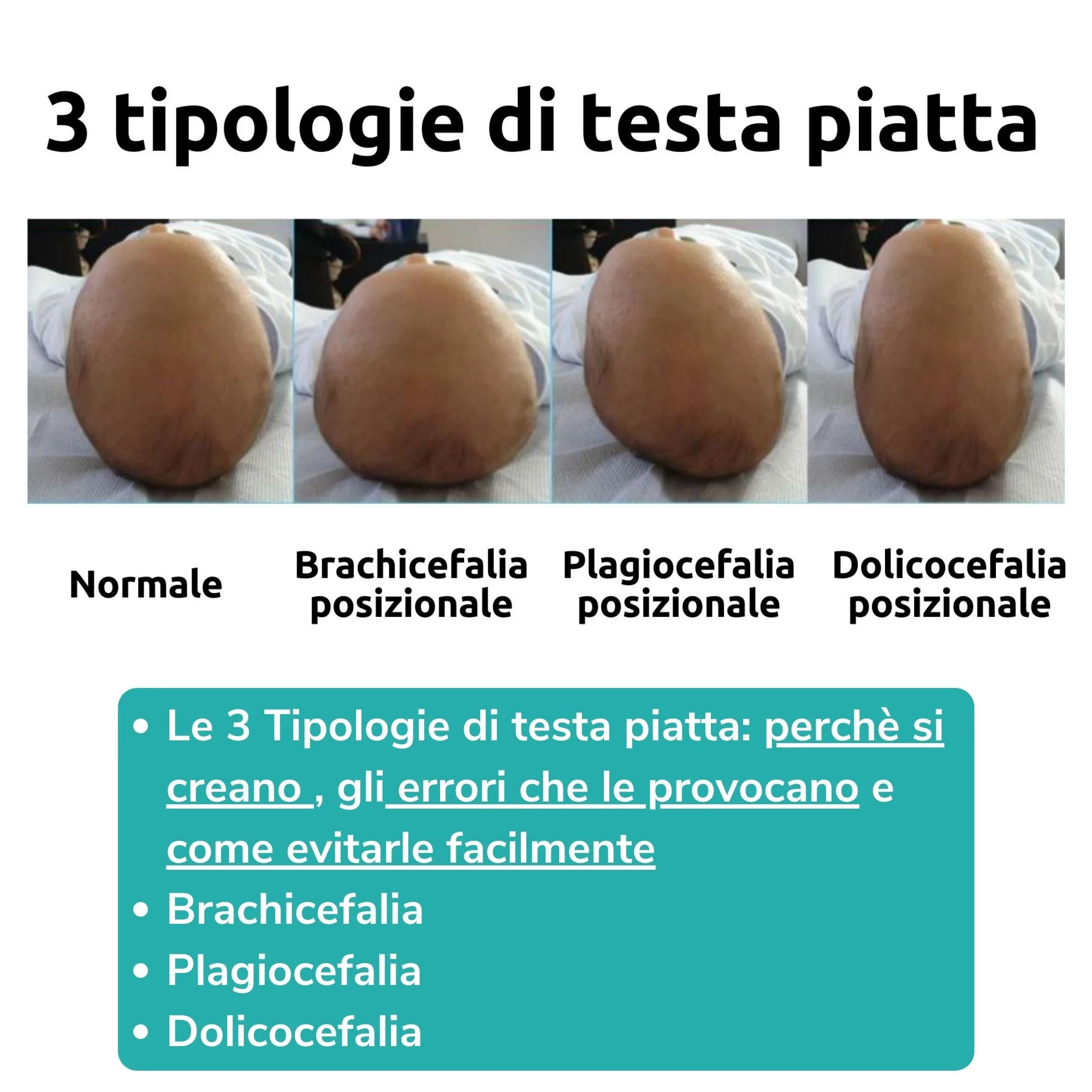 Bye bye testa piatta - immagine 8